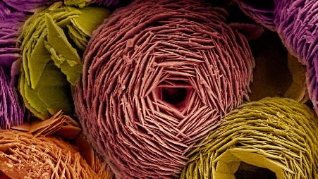 电子显微镜下的球霞石图像